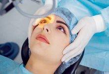 5 Myths of Laser Eye Surgery Dispelled
